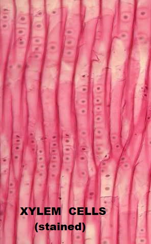 Xylem cells.